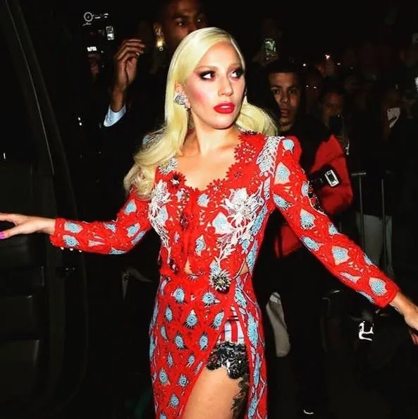 Lady Gaga elbisesinin azizliğine uğradı