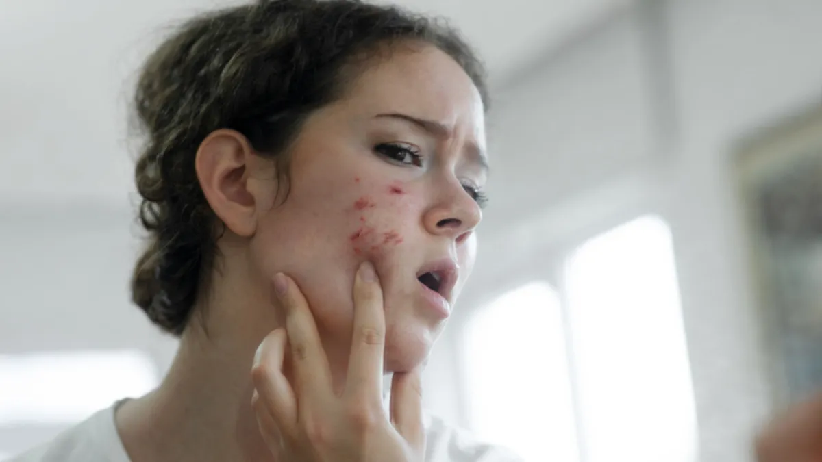 Gece bakımında yapılan kritik hata! Akneye davetiye çıkarıyor Gece bakımında yapılan kritik hata! Akneye davetiye çıkarıyor