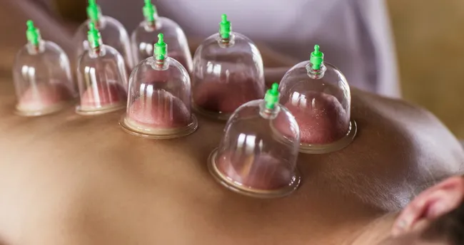 hacamat ile ilgili görsel sonucu