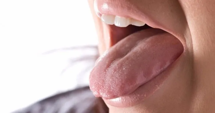 Dildeki yaralar ölümcül olabilir!