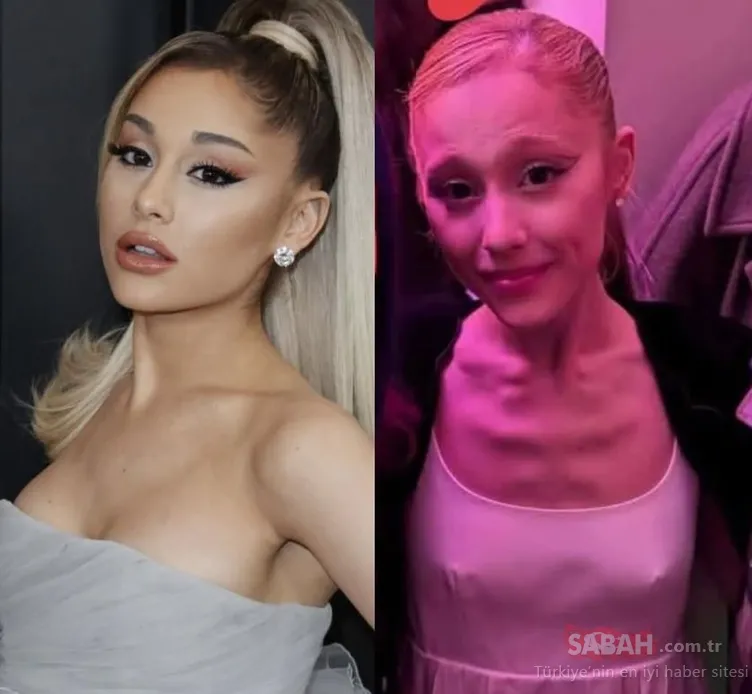 Anoreksiya ile mücadele ediyordu! Dünyaca ünlü yıldız Ariana Grande’nin son hali sevenlerini üzdü!