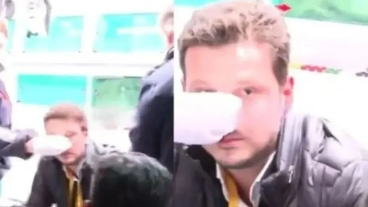Emre Kaplan'a yapılan çirkin saldırı için net yorum: Bu ülkede hukuk var! Kalleşçe yumruk, çalışanları yıldırmaz Emre Kaplan'a yapılan çirkin saldırı için net yorum: Bu ülkede hukuk var! Kalleşçe yumruk, çalışanları yıldırmaz