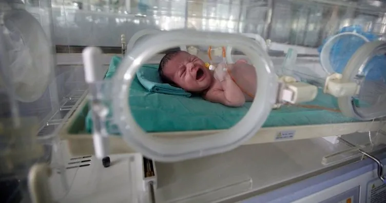 Hindistan’da bir bebek karnında ikiziyle doğdu
