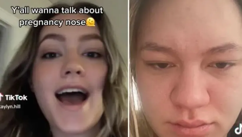 Hamilelikte büyüyen burun! Yaşayanlar anlattı: Kendimi tanıyamıyorum