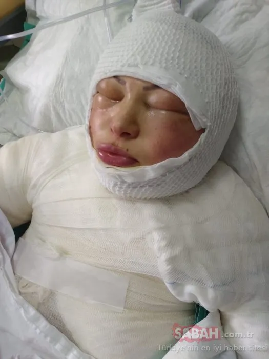 Son dakika: Ordu’da korkunç olay! Eşini ateşe verdi! Oturup yanmasını izledi