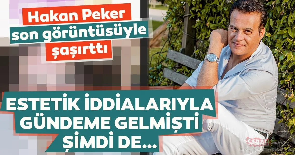 Hakan Peker son görüntüsüyle herkesi şaşırttı! Hakan Peker "Beni