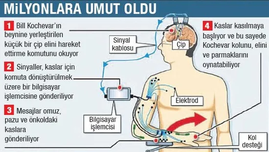 ABD’de felçli hastalar için çığır açacak çalışma... - 1