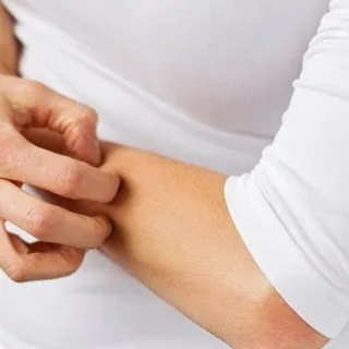 Uyuz salgını vakalarında artış görüldü! Uyuz salgını nedir, nasıl geçer?