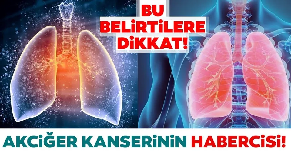 akciger kanseri belirtileri nelerdir
