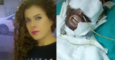 Son dakika | İstanbul’da genç kadının yüzünü kimyasal ile yaktı! İstenen cezayı duyunca şoka uğradı!