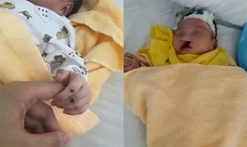 2 günlük bebek gömüldükten 8 gün sonra sağ çıkartıldı