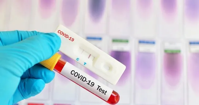Corona testi kaç günde çıkar? Korona testi kaç günde belli olur? E nabız  ile PCR covid-19 test sonucu sorgulama - Sağlık Haberleri