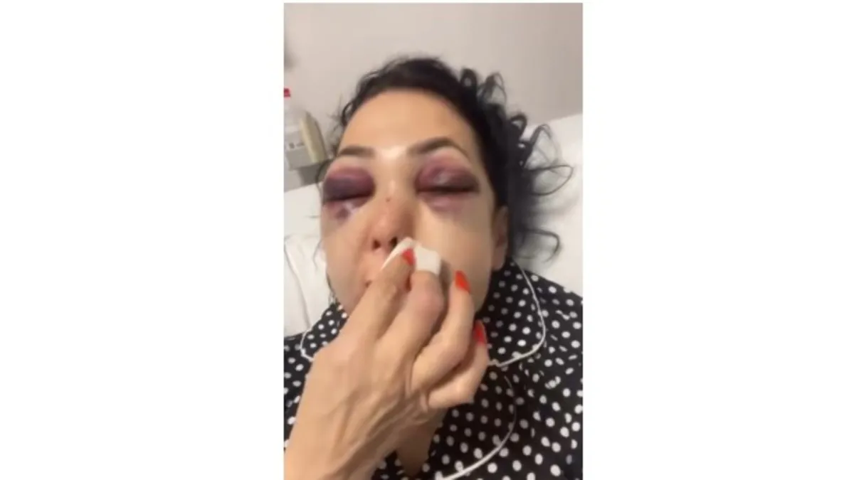 “Küfür etmeyin” dedi, bedelini ağır ödedi: Anne ve oğluna saldırı! “Küfür etmeyin” dedi, bedelini ağır ödedi: Anne ve oğluna saldırı!