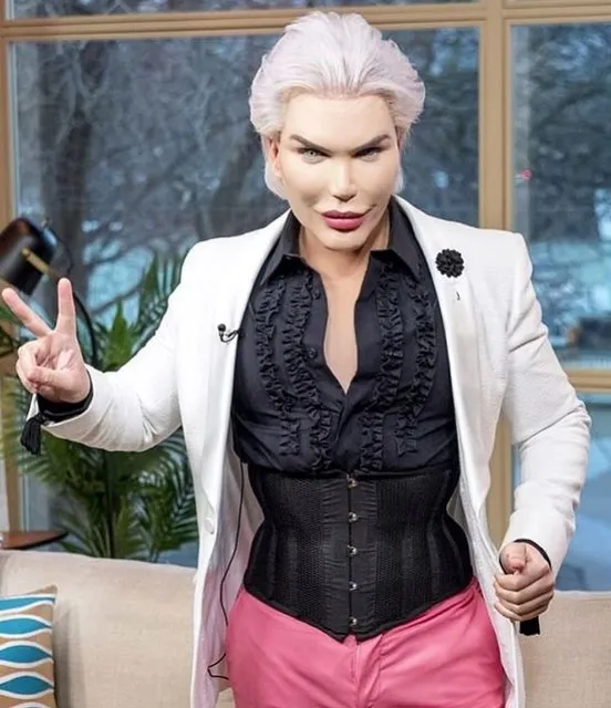İşte Ken Bebek Rodrigo Alves'in estetiksiz hali