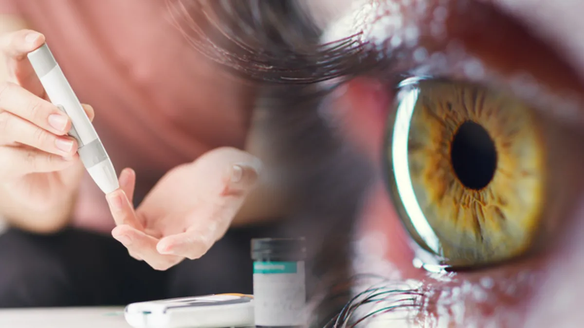 Her 10 kişiden 1’i hastalığının farkında bile değil! Diyabet gözleri hızla yok ediyor… Her 10 kişiden 1’i hastalığının farkında bile değil! Diyabet gözleri hızla yok ediyor…