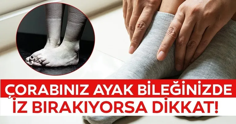 Bu uyarılara dikkat! Kalbin düzgün çalışmadığını gösteren sekiz önemli işaret