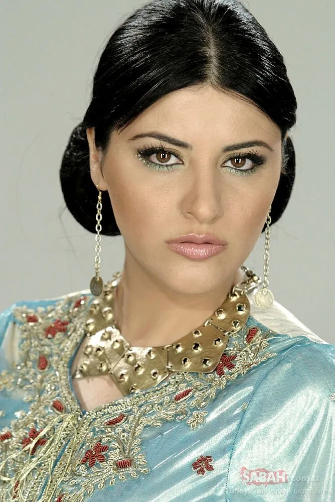 Nurgül Yeşilçay’ın botokslu hali çok konuşulmuştu! Son estetik