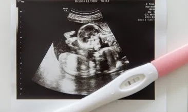 İdrar gebelik testi negatif çıktı ama adetim gecikti! Hamilelik testi negatif çıkıp hamile olanlar oluyor mu?