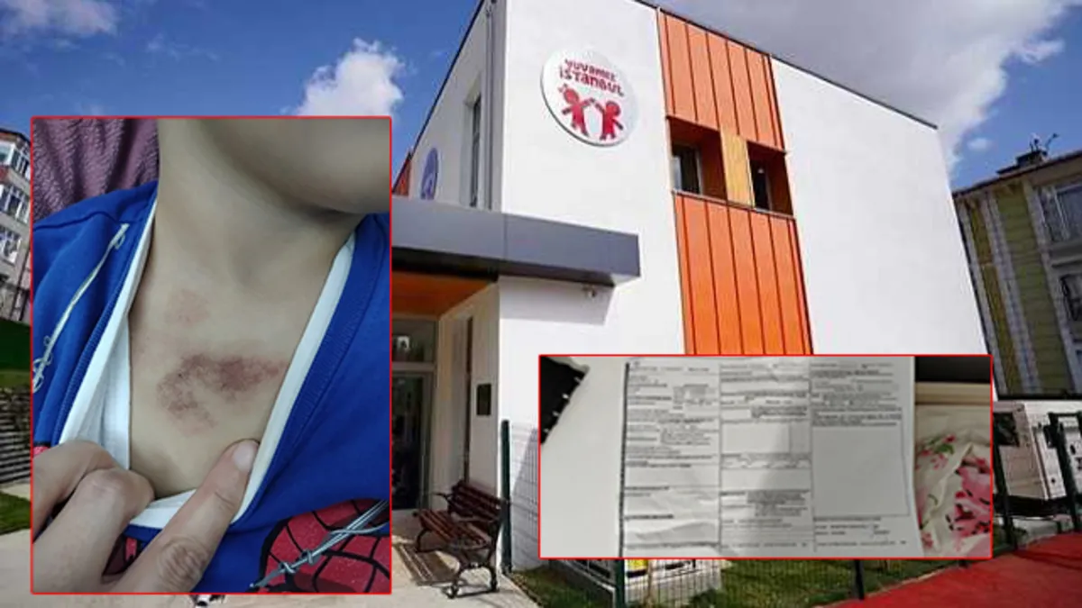 İBB kreşinde taciz ve darp iddiası! Aile şikayetçi oldu Valilik’ten jet soruşturma İBB kreşinde taciz ve darp iddiası! Aile şikayetçi oldu Valilik’ten jet soruşturma