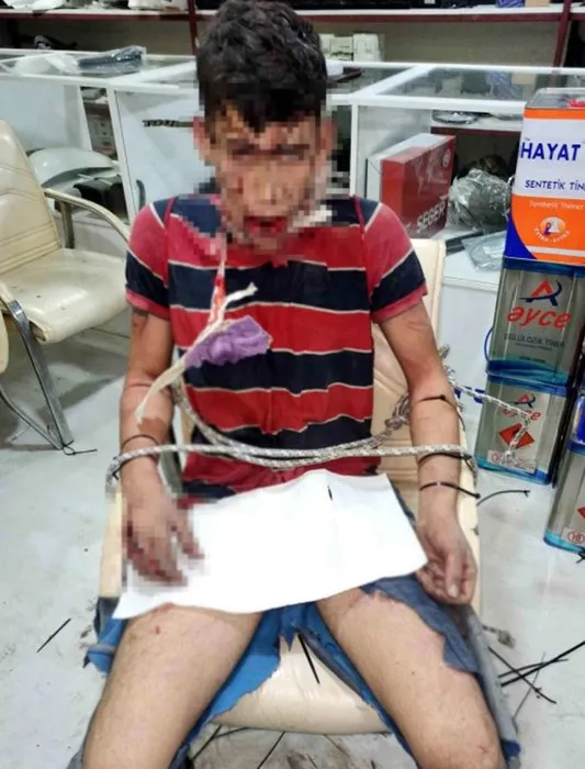 Antalya’daki kan donduran olayda flaş gelişme! Ağzıma böcek koyup dişimi kırdılar!