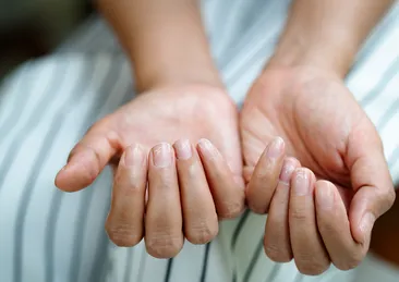 Tırnak batmasının sebepleri nelerdir?