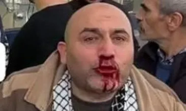 Filistin’e destek mitinginin dönüşünde saldırıya uğradı! Üniversiteli saldırgan tutuklandı