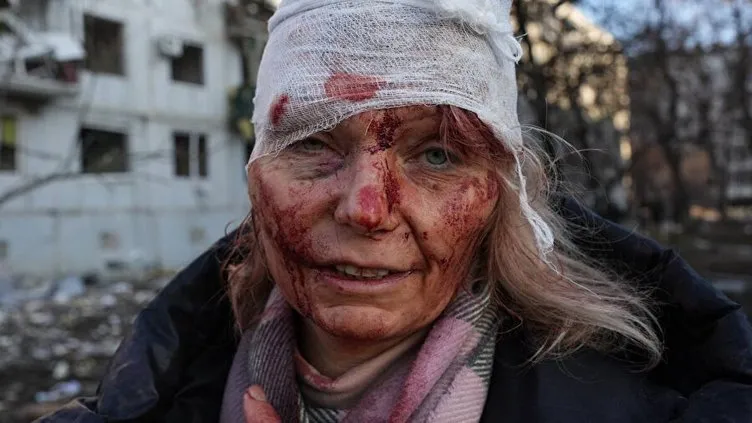 Son dakika: Rusya Ukrayna savaşında simge oldu! Dünyanın konuştuğu kadının sözleri kan dondurdu!