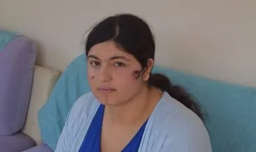 İzmir’de öldüresiye dövülmüştü: Genç kadın yaşadığı dehşeti anlattı! #izmir İzmir’de öldüresiye dövülmüştü: Genç kadın yaşadığı dehşeti anlattı! #izmir