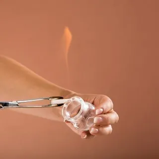 Hacamat nedir? Hacamatın faydaları nelerdir?
