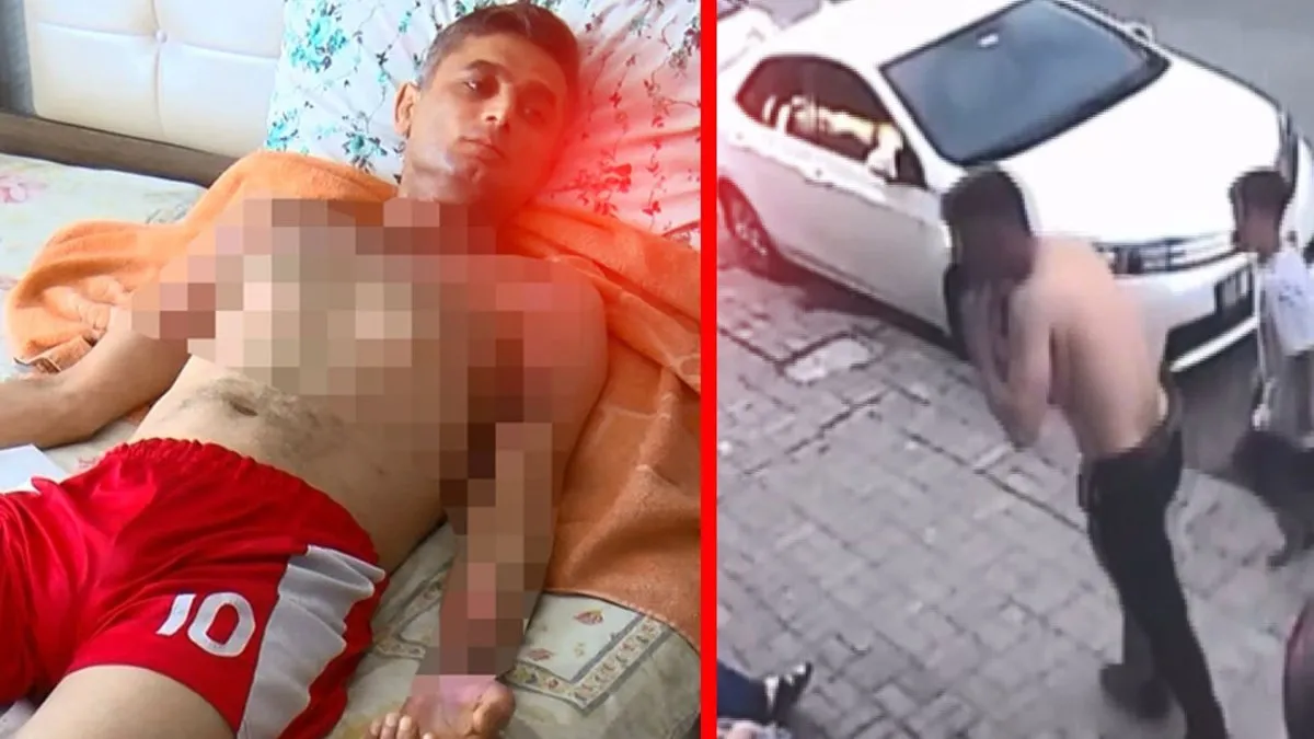 Gaziosmanpaşa'da akılalmaz vahşet! Duyma engelli Ahmet'i önce gasbetti sonra benzinle ateşe verdi!