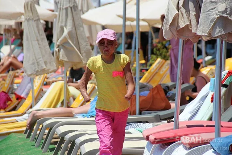 Zehra Birgül Ağaç tam 38 ameliyat geçirdi. İşte son hali… Galeri