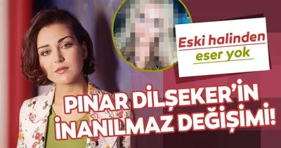 Onu tanıyabilene aşk olsun! Şarkıcı Pınar Dilşeker estetiğin dozunu fena kaçırdı! Pınar Dilşeker’in son hali gündem oldu!