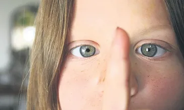 Şaşılığın tedavisi mümkün