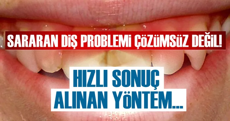 Sararan diş problemi çözümsüz değil