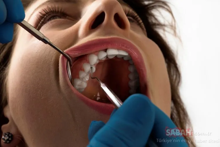 Yirmili diş hakkında bilmeniz gerekenler!