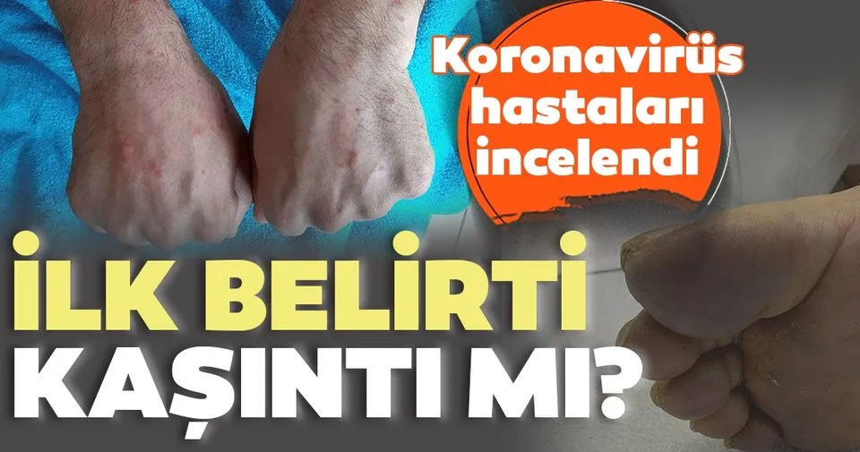 ilk belirti kasinti mi