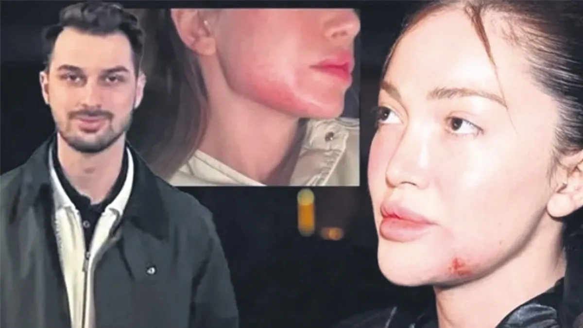 Dayakçı sevgili ile uzlaşmadı Dayakçı sevgili ile uzlaşmadı