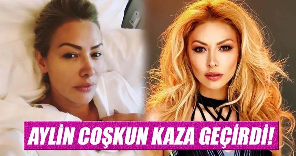 aylin coskun kaza gecirdi son dakika