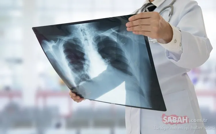 Uzmanlar akciğerleri temizleyen en etkili besini açıkladı! İşte güçlü akciğerler için tüketmeniz gerekenler...