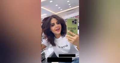 Azeri kızı Günel Zeynalova estetiğin dozunu fazla kaçırdı! Sosyal medya paylaşımı olay oldu | Video