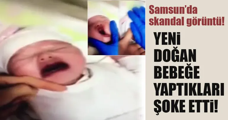Samsun’da şok! Yeni doğan bebeğe işkence!