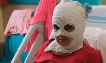 Erzurum’da şampiyonluk kutlamasında faciaya dönüşen anlar: 7 yaşındaki Aysima ağır yaralandı #erzurum