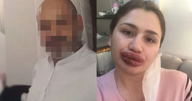 Sahte Estetikci Kuafore 2 Yeni Dava Sayfa 3 En Son Haber
