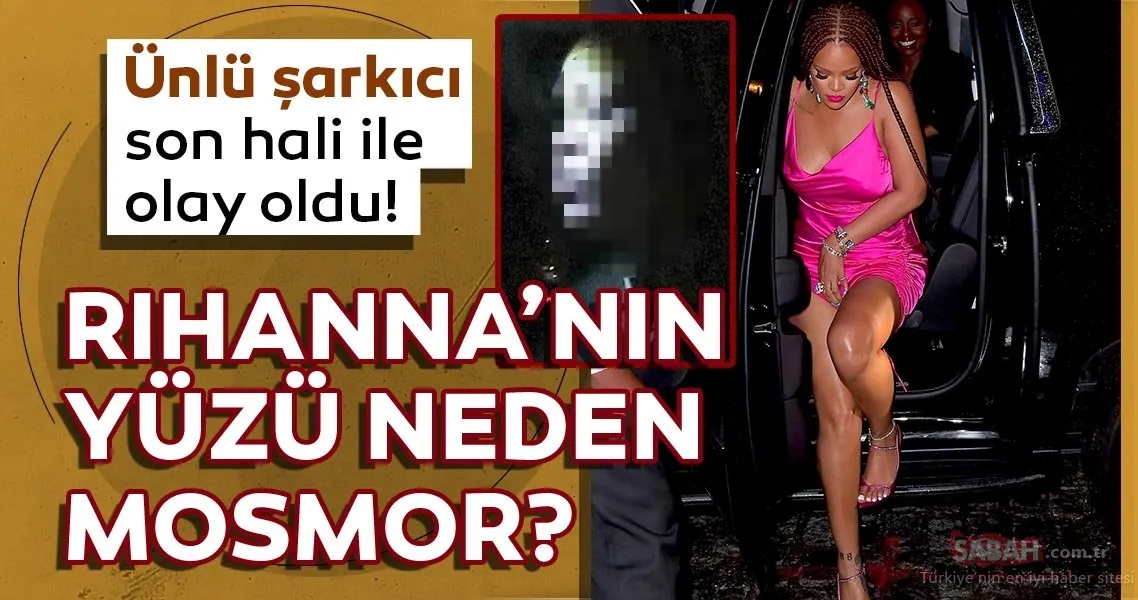 Rihanna�nın yüzü neden mosmor? Rihanna son hali ile hayranlarını