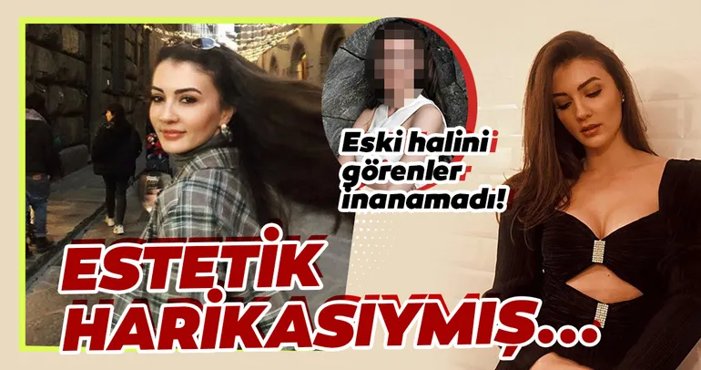 Afilli Aşk’ın Ayşe’si Burcu Özberk meğer estetik harikasıymış... Afilli Aşk’ın güzel oyuncusu Burcu Özberk değişimi ile herkesin dilinde...