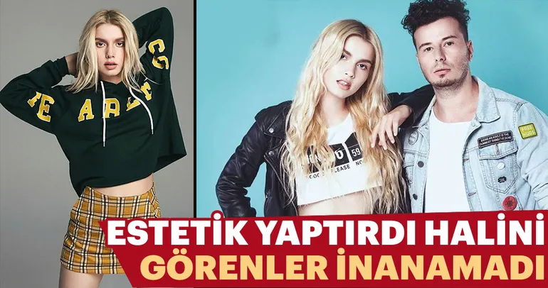 İşte ünlülerin estetiksiz hali...