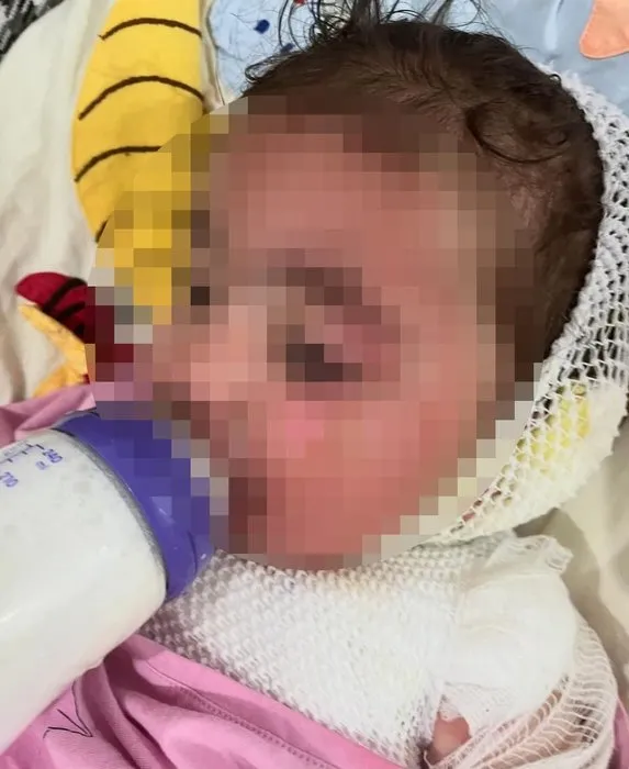 Anaokulunda üzerine kahve dökülen 1.5 yaşındaki Aden Aslan’da ikinci derece yanıklar oluştu! Kahrolan anne: Benim evladım acı çekiyor