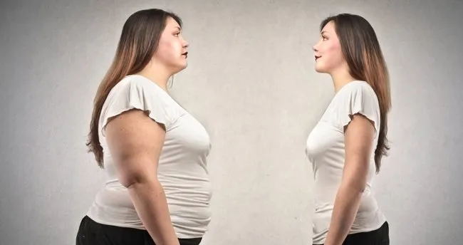 Tup Mide Ameliyati Nedir Ve Fiyati Ne Kadar Saglik Haberleri