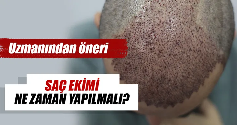 Saç ekimi ne zaman yapılmalı?