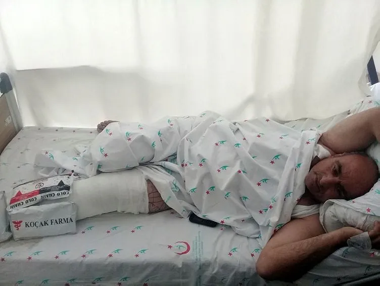 Eyüpsultan’da feci kaza! Genç kız sağ bacağını kaybetti